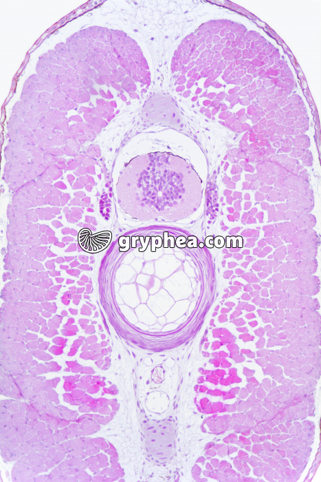 Tétard chorde et moelle épinière in situ CT x40 - gryphea.org